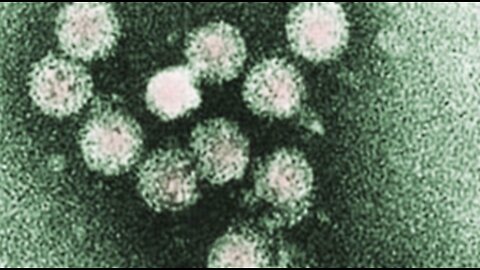 New cases of hepatitis A in Palm Beach County, bringing total to 23 this year