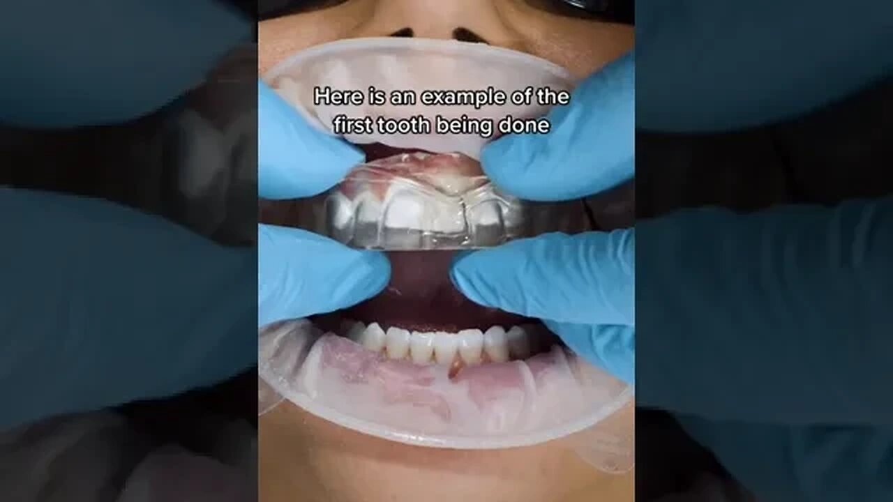 Dental And Teeth Hygiene