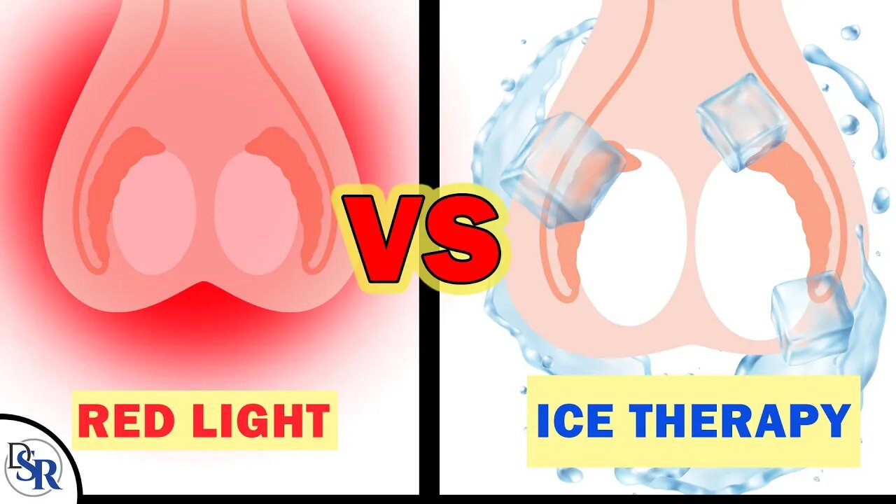 𝗧𝗲𝘀𝘁𝗼𝘀𝘁𝗲𝗿𝗼𝗻𝗲 𝗣𝗿𝗼𝗱𝘂𝗰𝗶𝗻𝗴 𝗧𝗲𝘀𝘁𝗶𝗰𝗹𝗲𝘀: Red Light Or Ice Therapy?