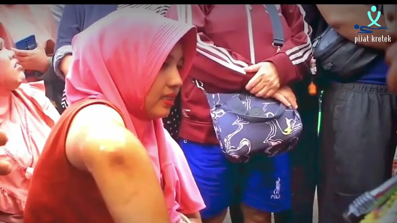 Pengobatan Ibu Ida Dayak | pernah jatuh dari motor dan jari mungil ini tidak bisa dibengkokkan