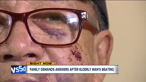 Family hopes for arrest after brutal beating