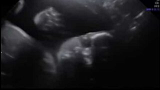 Un bébé fait coucou pendant l'échographie