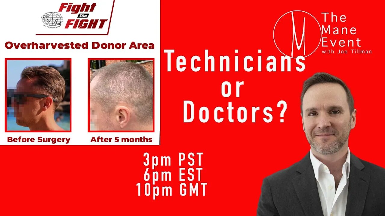 Hair Transplant Doctor or Technicians? The Mane Event - Wednesday, August 23rd