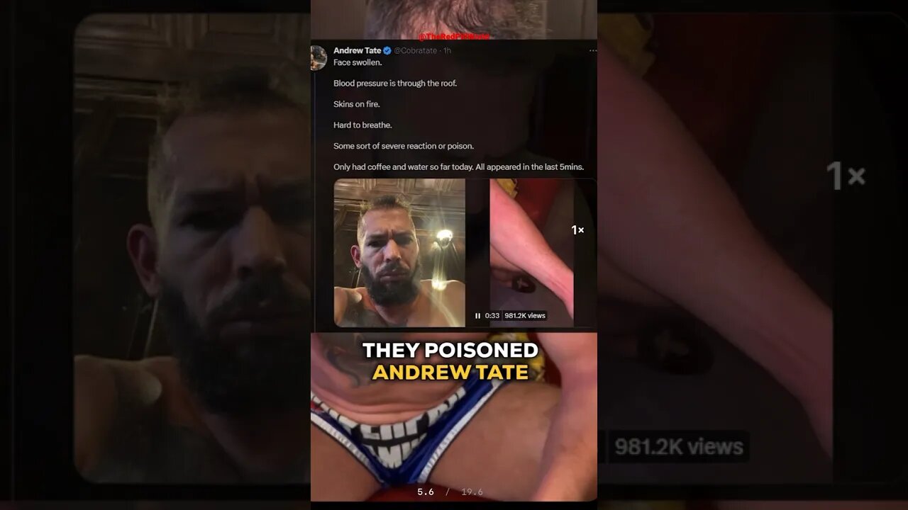 Andrew Tate Got Poisoned! #shorts #trending