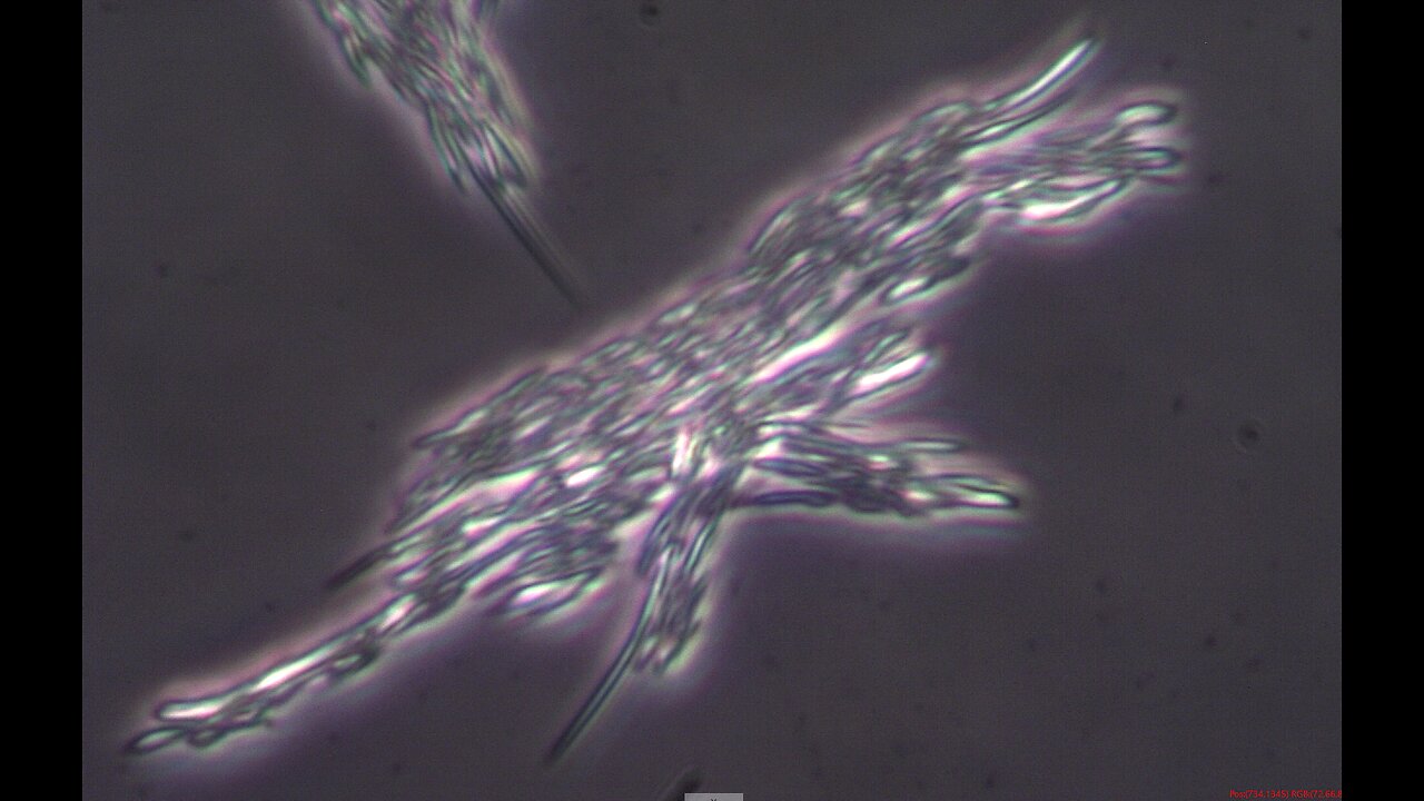 What Does Spike Protein Look Like in the Live Unchanged Blood? - Video 1