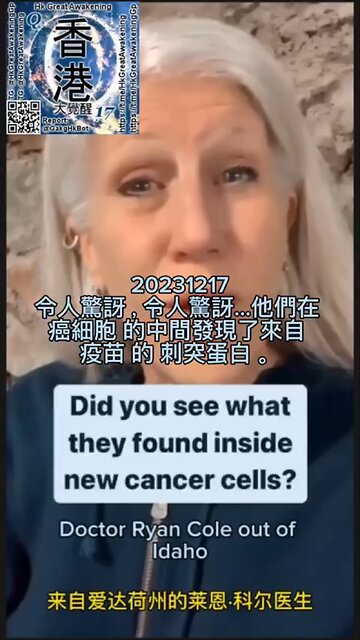 在 #癌細胞 的中間發現了來自 #疫苗 的 #刺突蛋白 。