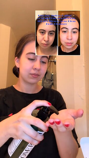 First impressions- AHA BHA PHA 30 Days Miracle Acne Clear Body Cleanser TEATREE