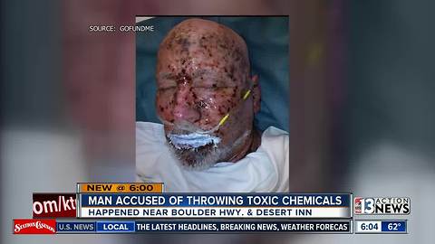 Las Vegas police: Suspect throws toilet bowl cleaner at man's face, burning him