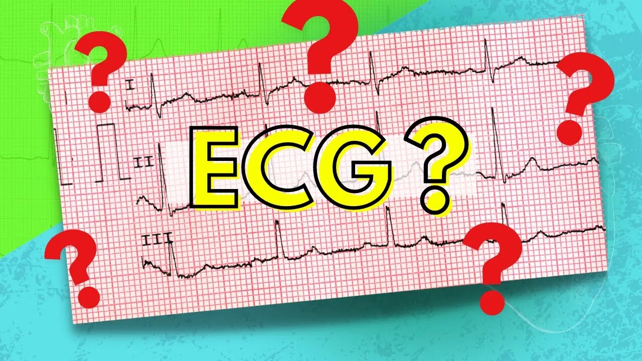 How to Read an Electrocardiogram (ECG/EKG)