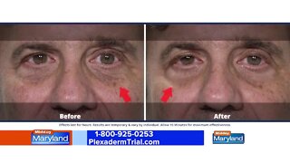 Plexaderm - Trial Pack