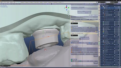 Making a transfer coping on an implant abutment