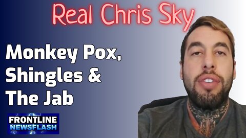 Chris Sky - Monkey Pox, Shingles and the Covid Jabs