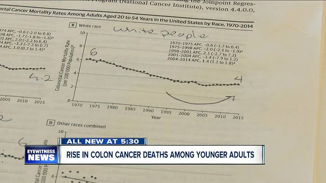 Colon cancer rates up among young white males