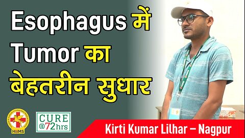 Esophagus में Tumor का बेहतरीन सुधार