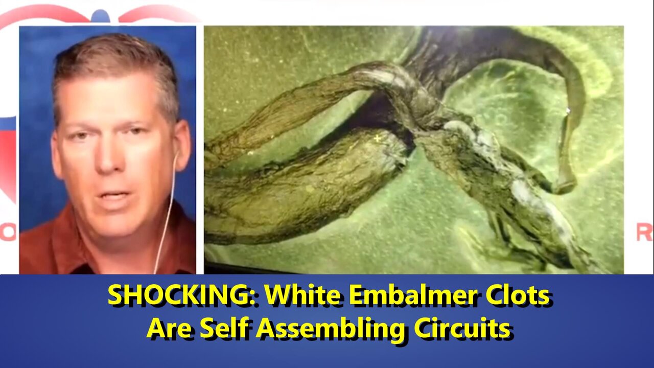 SHOCKING White Embalmer Clots Are Self Assembling Circuits Plus THE MRNA INJECTION CULLING.