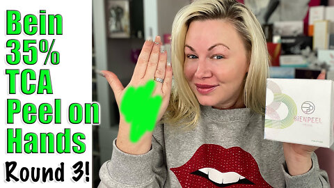 Bein 35% TCA Peel on Hands: Round 3 from Acecosm.com | Code Jessica10 saves you Money