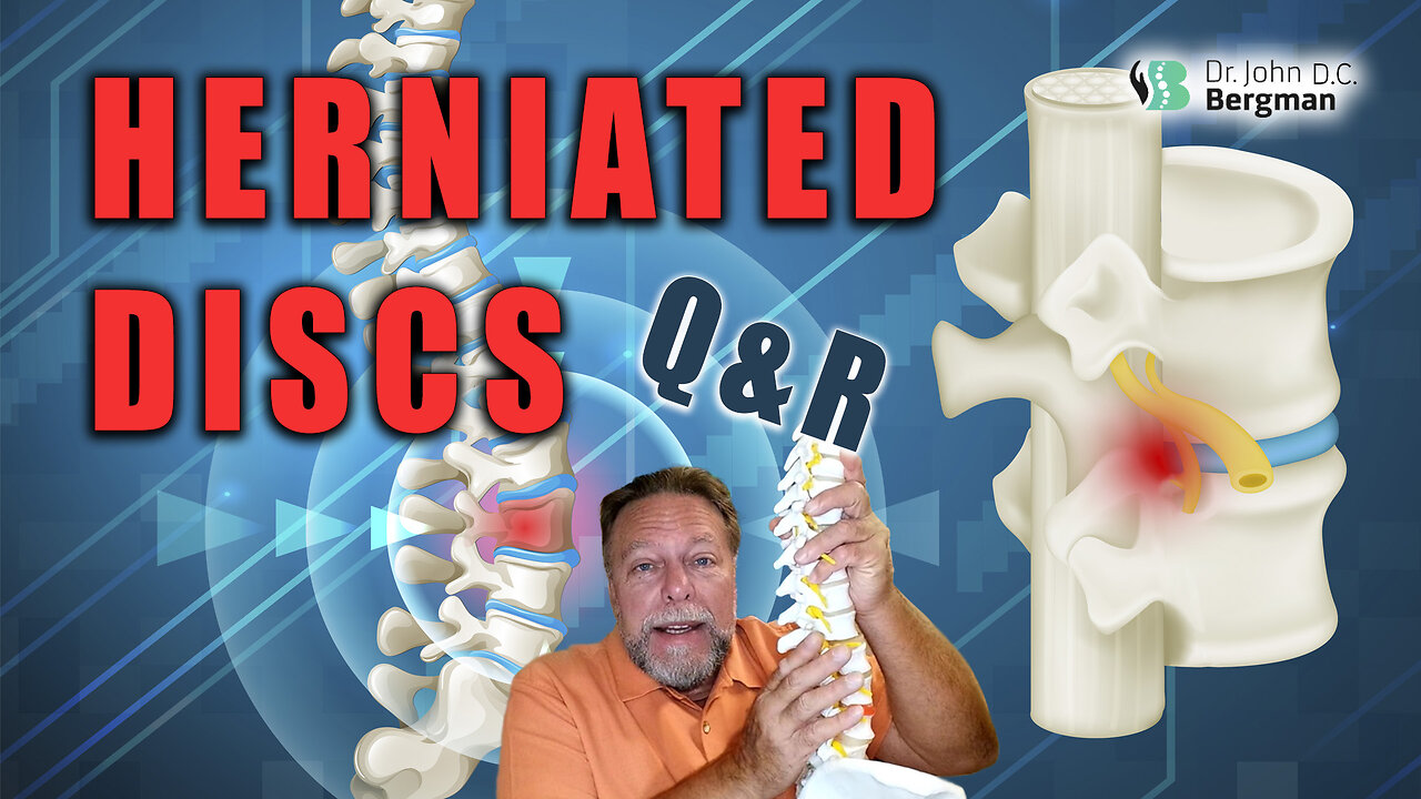 Herniated Discs Q&R (Timestamps Below)