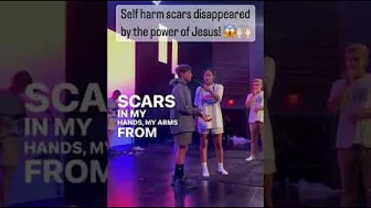 SCARS DISAPPEAR SUPERNATURALLY IN WORSHIP! Watch! #miracle #jesus