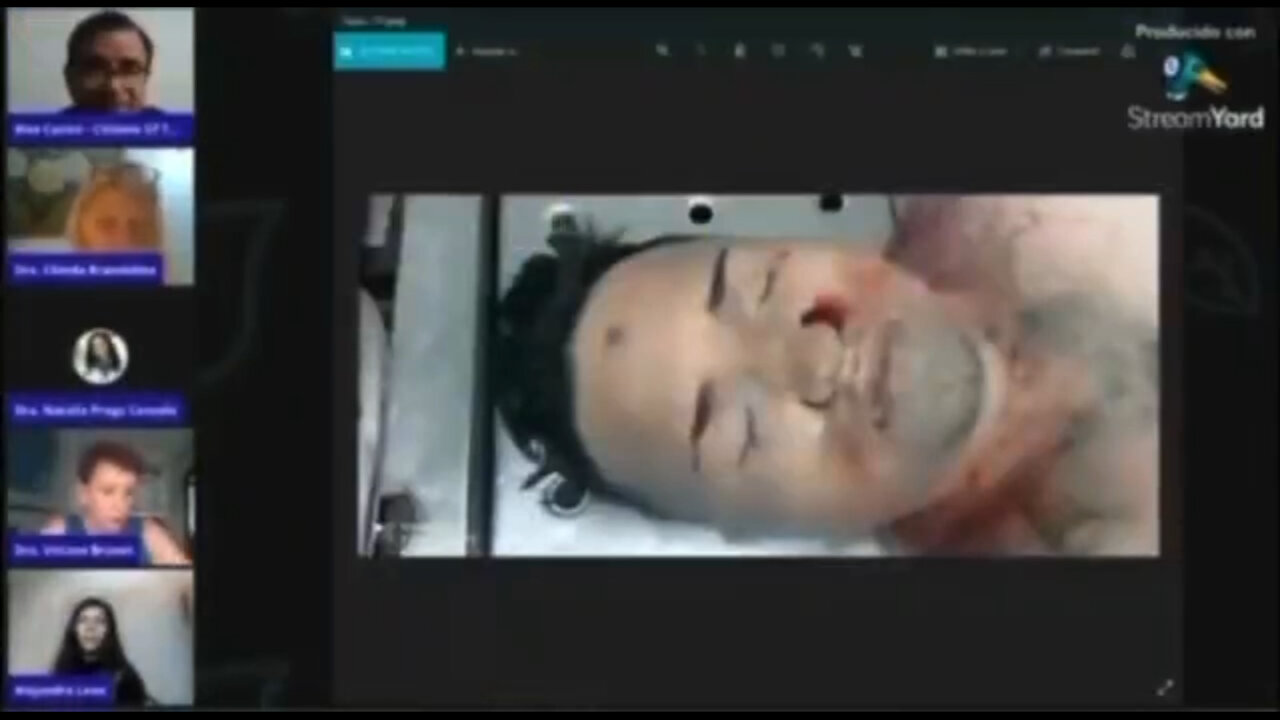 Autopsia en un joven que se puso la terapia genética.