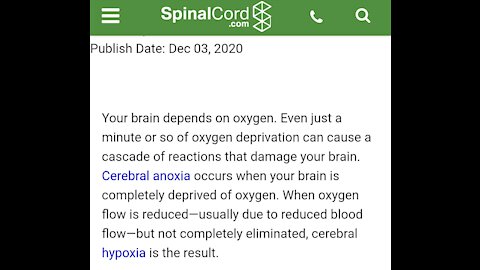 Covid 19 Vaccine Lawsuit