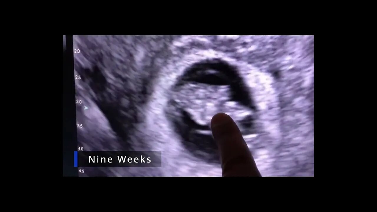 Take a Peek: Weeks 6 to 12 in Pregnancy Scans | Ultrasounds!