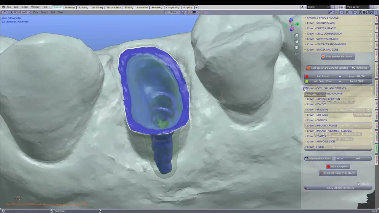 Making a one piece post and core crown