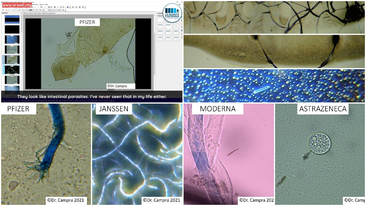 Observations of Possible Microbiota in COVID mRNA Vaccines by Dr. Pablo Campra Madrid