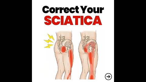 Correct your Sciatica
