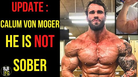 Calum Von Moger is NOT Clean & Injuries Disclosed