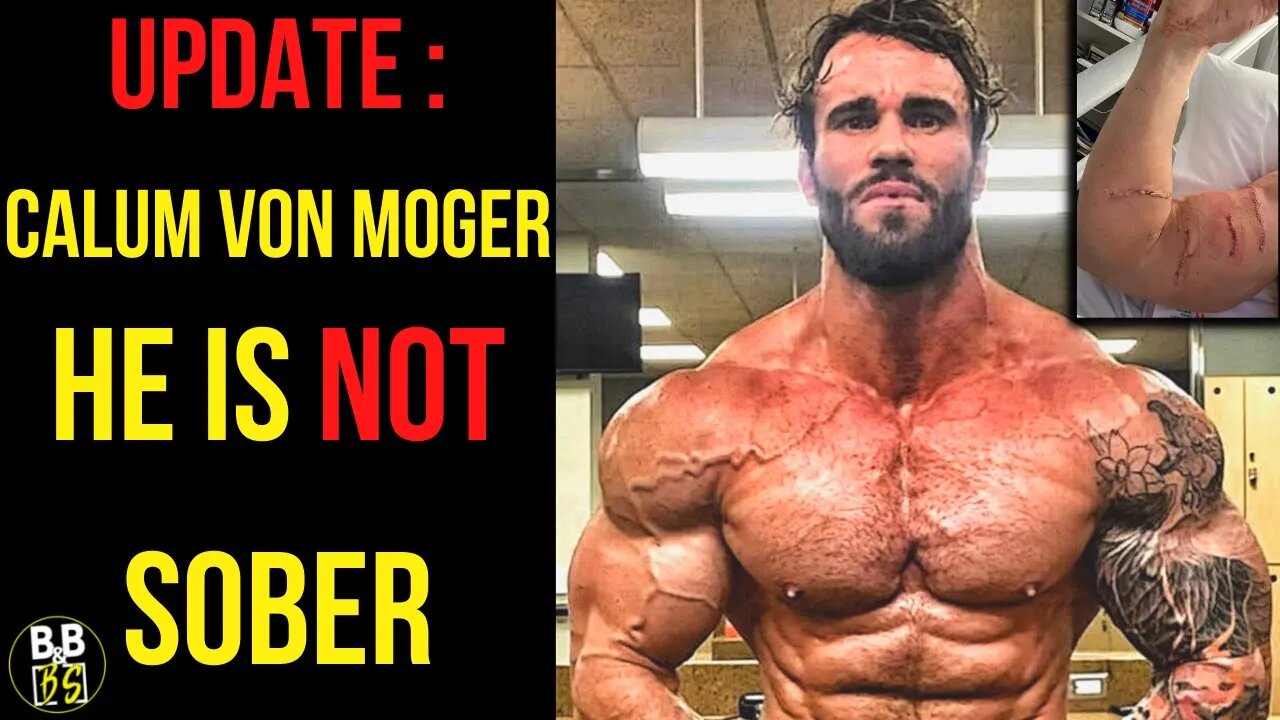 Calum Von Moger is NOT Clean & Injuries Disclosed