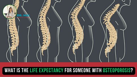 What is the life expectancy for someone with osteoporosis? | DR. MAI