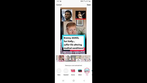 Both Bronny James, Singer Tori Kelly....suffer LIFE ALTERING medical conditions!