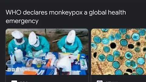 MONKEYPOX PANIC HEADED TO A TOWN NEAR YOU. MON WE SCOOP UP $CMRX $EBS $SIGA & CONT 2 SQUEEZE $TBLT