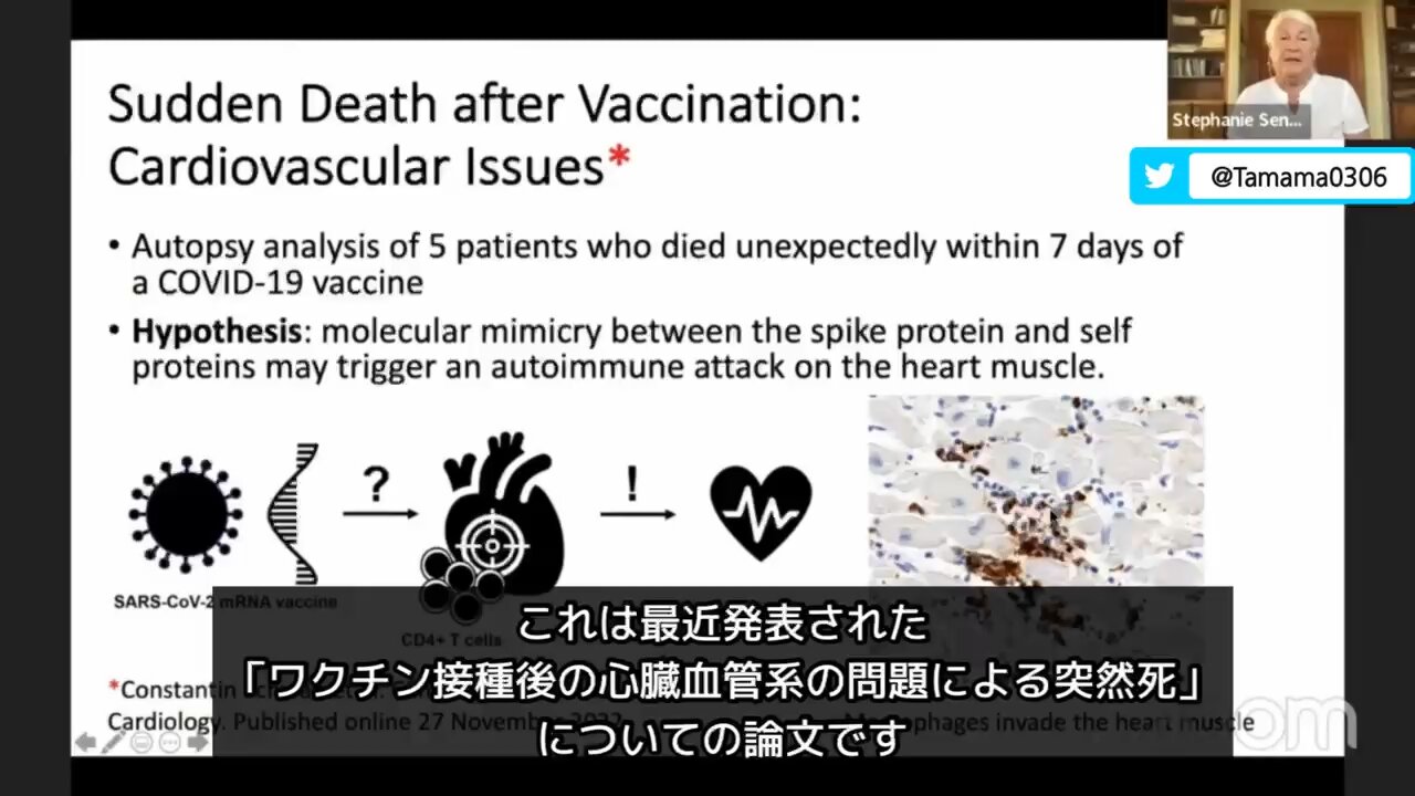 【コロワク】接種後に心臓突然死をした5人の患者についての研究結果