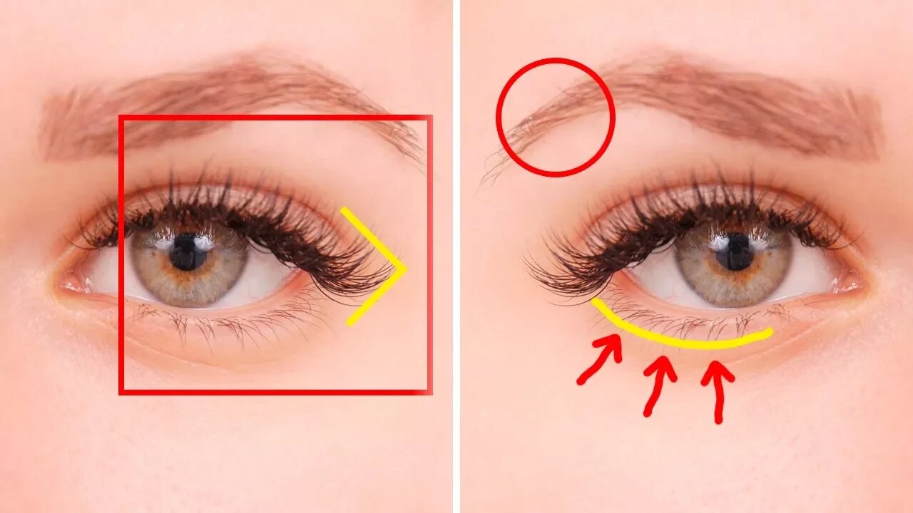 5 Things Your Eyes Are Trying To Tell You About Your Health