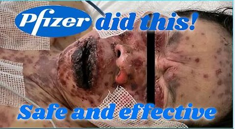 #76 Pfizer and friends killing in the name of MONEY!!!