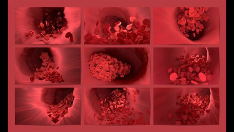 CDC & Pfizer Issue Warning: “EVERYONE Is at Risk for Blood Clots”