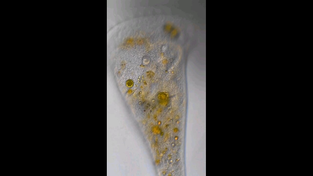 Close-up shot of a Stentor (Ciliate). You can see all of the food it filtered. I love these things! ππ«ΆπΎπ¬