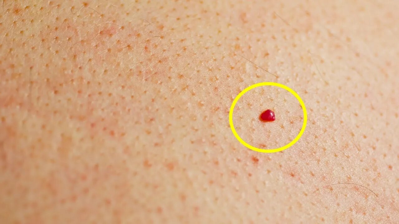 Do You Have Red Spots On Your Skin? Here's What They Mean...