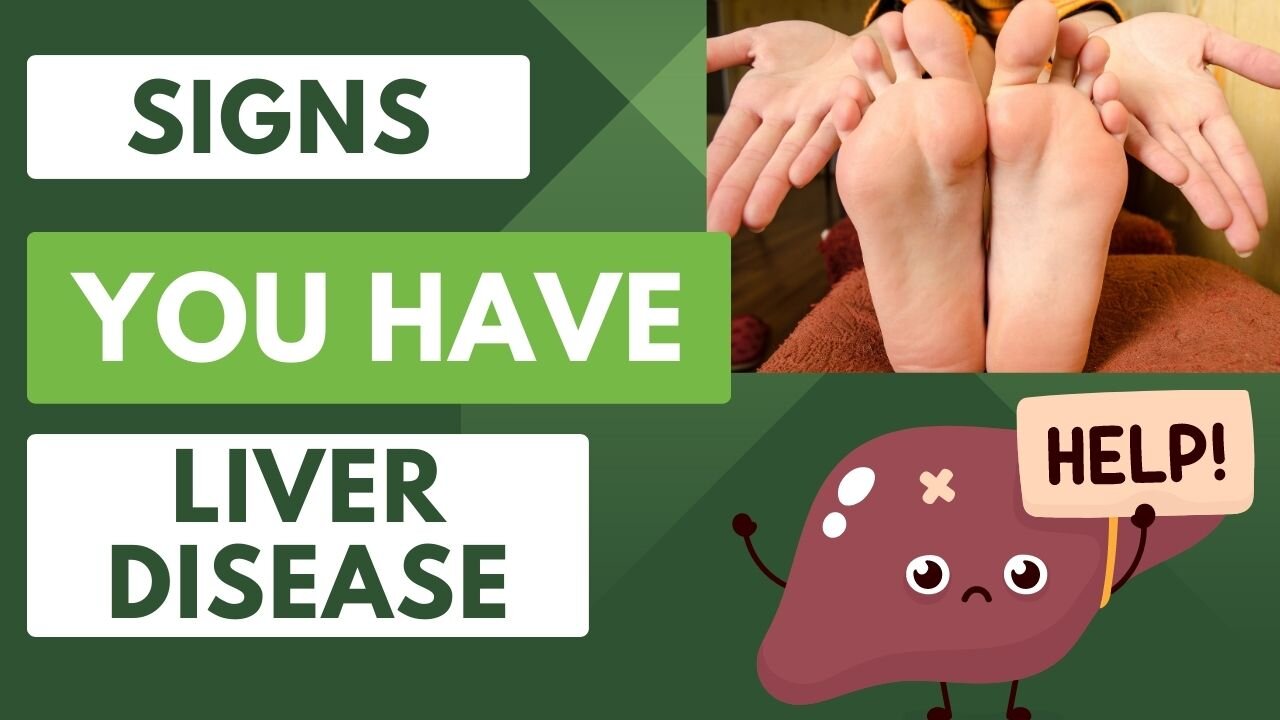 Your Hands and Feet Speak Louder Than Words: Understanding Liver Warning Signs