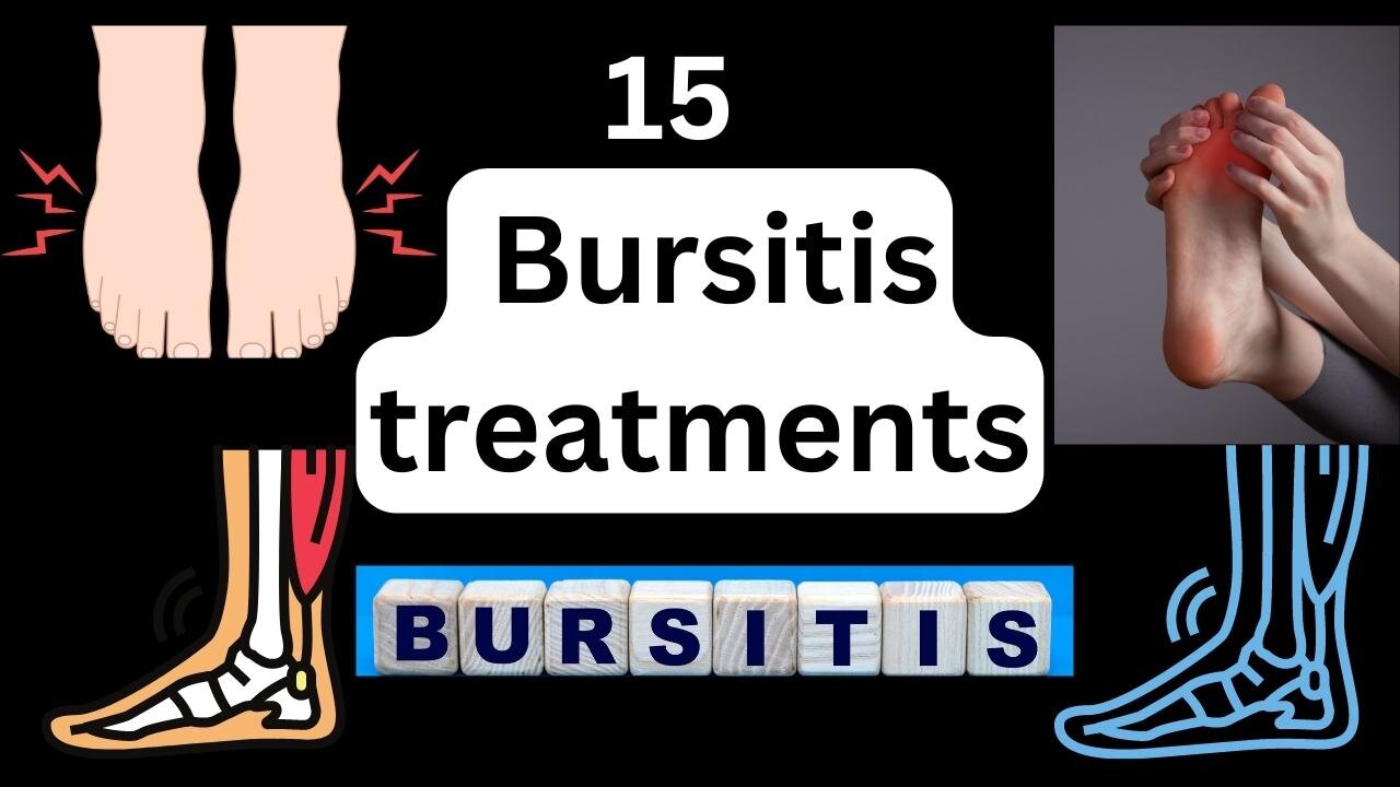 15 Bursitis treatments