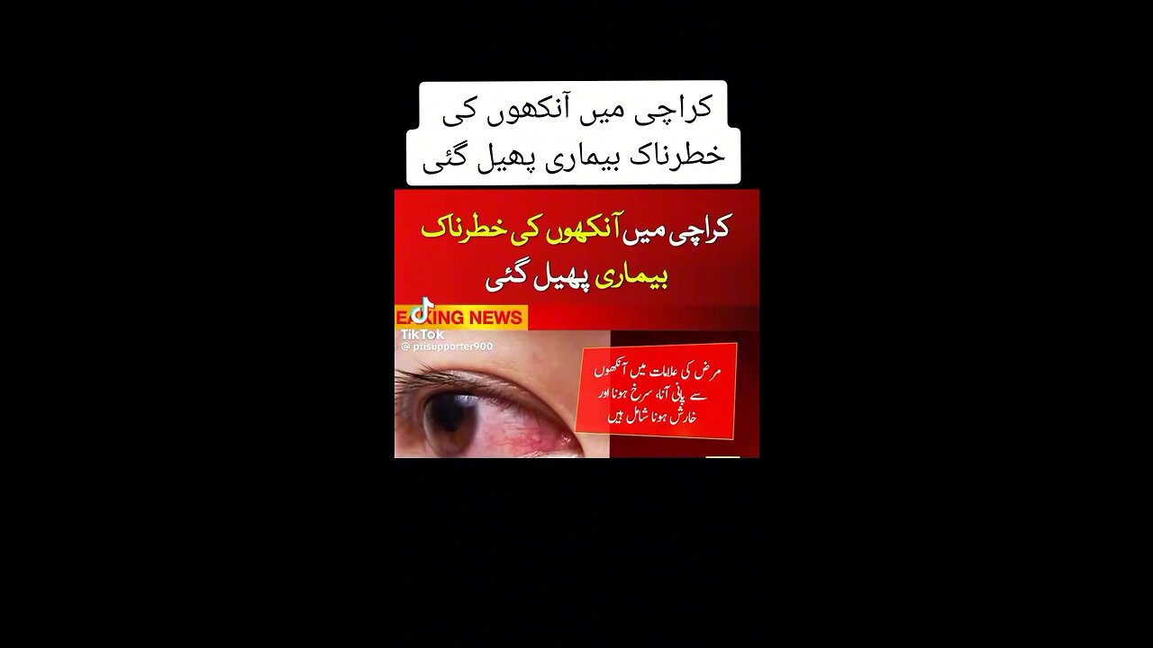 Eyes v