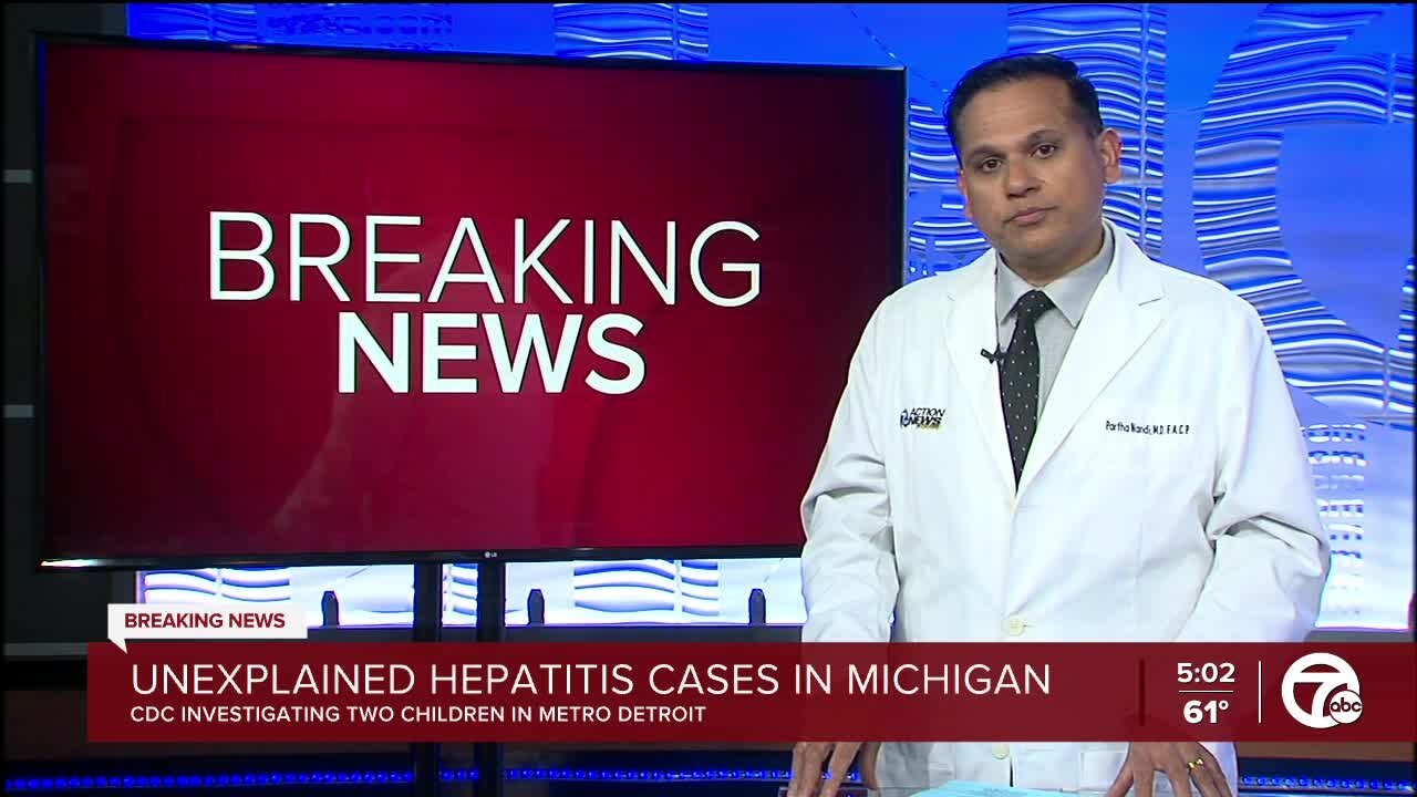 Michigan reporting first cases of possible unexplained hepatitis in children