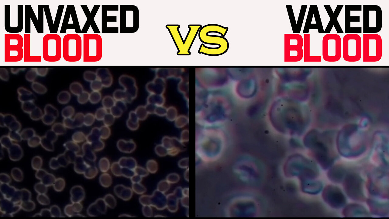 BLOOD SAMPLE UNVACCINATED VS VACCINATED BLOOD TEST COVID VACCINE CLOT