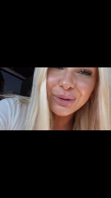 This 22 year old looks 45 because Instagram convinced her she needs botox to be "pretty"