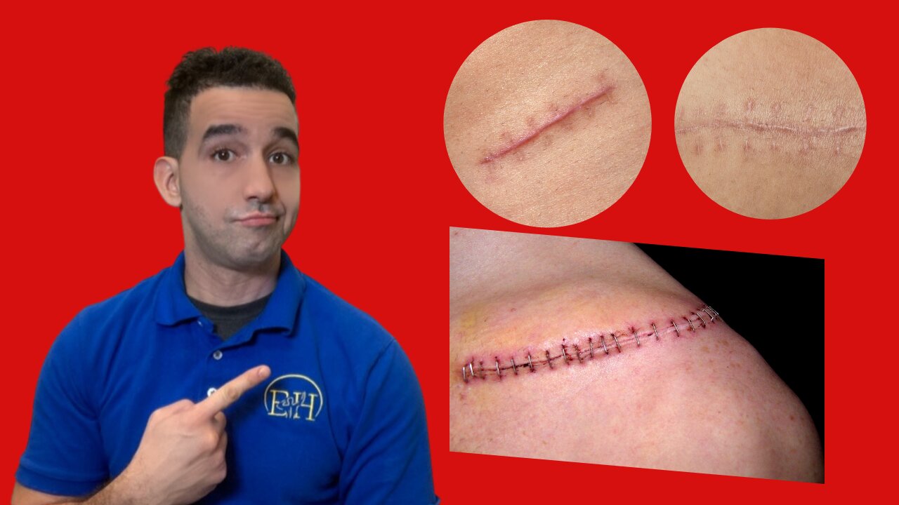 Scar Tissue Holding You Back? Discover How Massage Therapy Can Help!