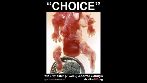 PLANNED PARENTHOOD, DR. ABBY JOHNSON ON SECRET ABORTIONS