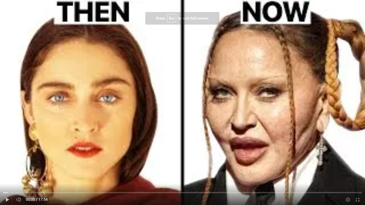 Madonna Plastic Surgeries - Surgeon Reacts