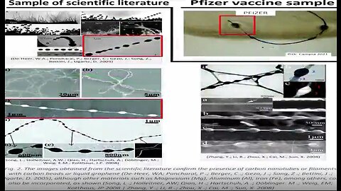 Pfizer COV-ID NANO-BIO (Transhumanist) POISON INJECTION (La Quinta Columna Review) - 7-30-22