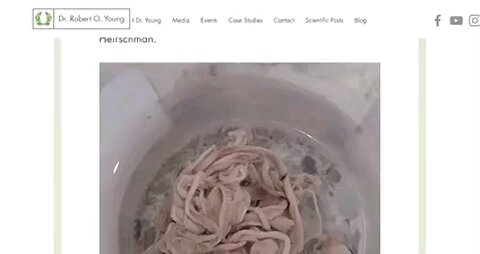 Doctor Outlines What He Has Been Seeing In Jabbed Autopsies- Deep